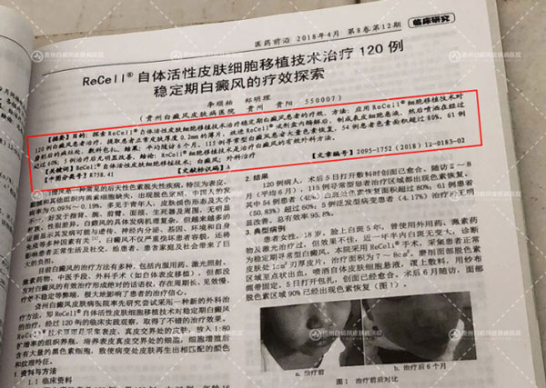 喜讯:我院专家论文荣登权威杂志期刊