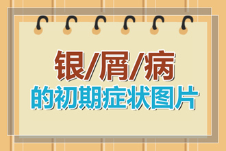 体癣和牛皮癣在身体上面有哪些不同