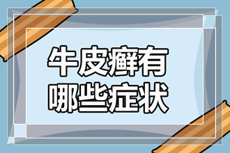 在身体上牛皮癣出现早期时候的症状有哪些