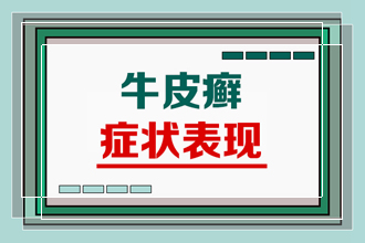 身上干干的牛皮癣癣是怎么引到身上的